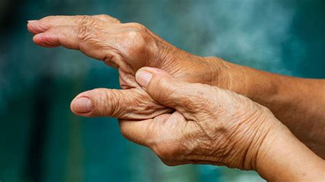 exacerbarea artritei cronice